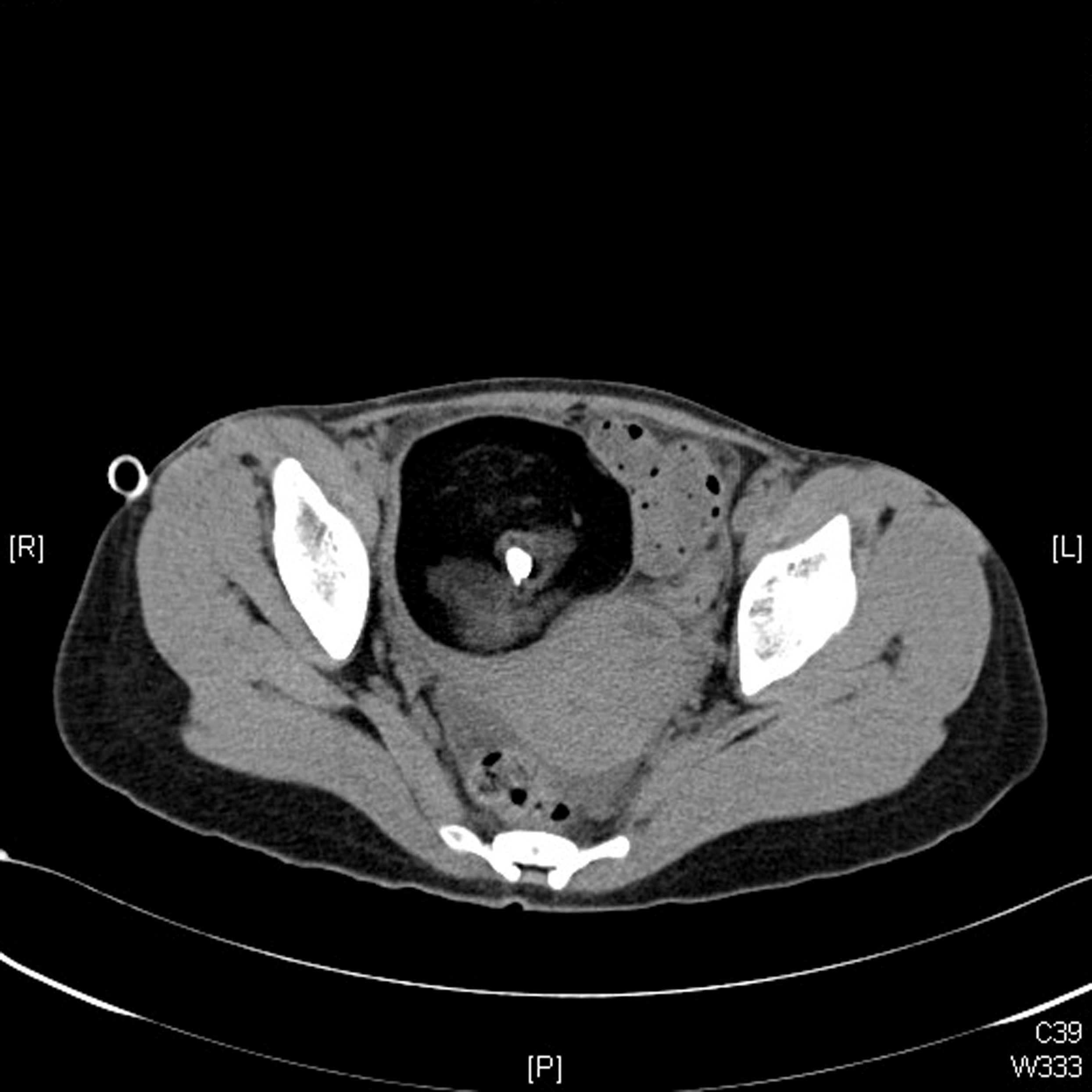CT - fig 1